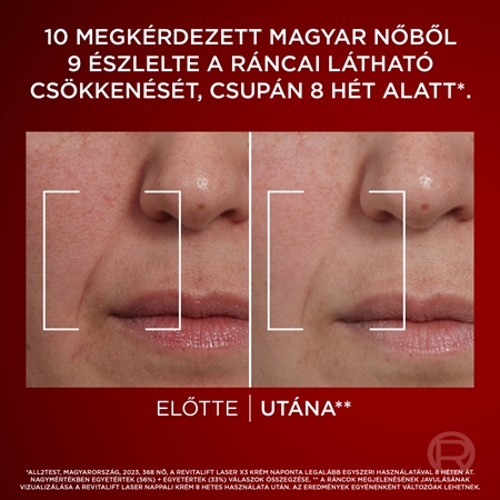 L’Oréal Paris Revitalift Laser X3 ránctalanító, intenzív nappali arckrém