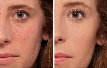 L’Oréal Paris Accord Parfait The One correcteur liquide