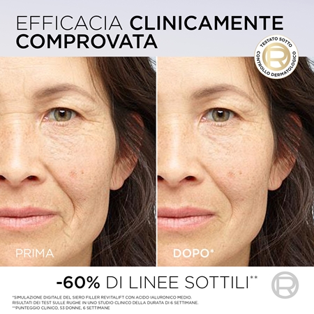 L’Oréal Paris Revitalift Filler siero antirughe con acido ialuronico