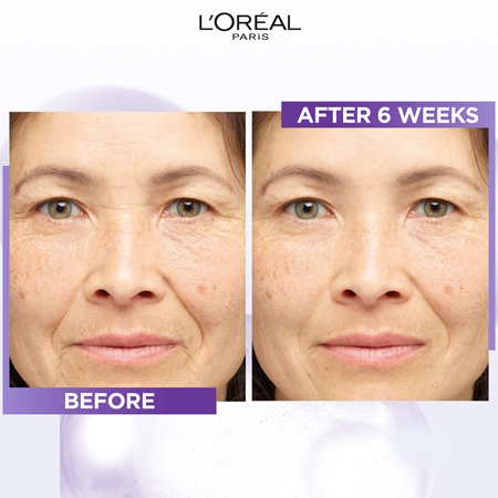 L’Oréal Paris Revitalift Filler sérum proti vráskám s kyselinou hyaluronovou