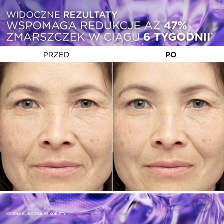 L’Oréal Paris Revitalift Filler serum przeciwzmarszczkowe z kwasem hialuronowym