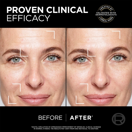 L’Oréal Paris Age Perfect Cell Renew Midnight regenerační pleťové sérum