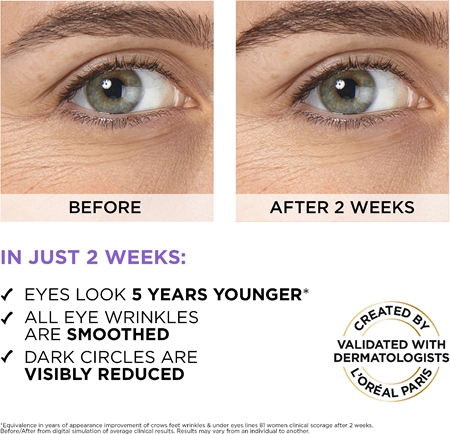 L’Oréal Paris Revitalift Filler siero occhi illuminante con acido ialuronico