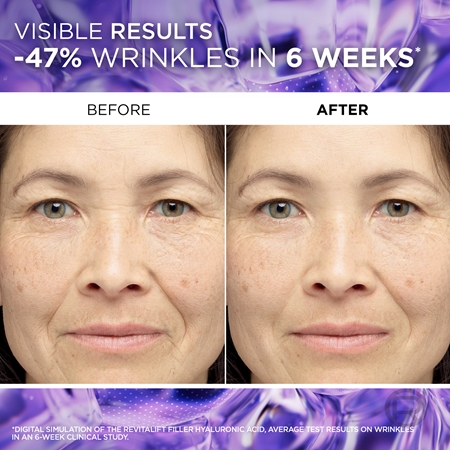 L’Oréal Paris Revitalift Filler ser antirid cu acid hialuronic