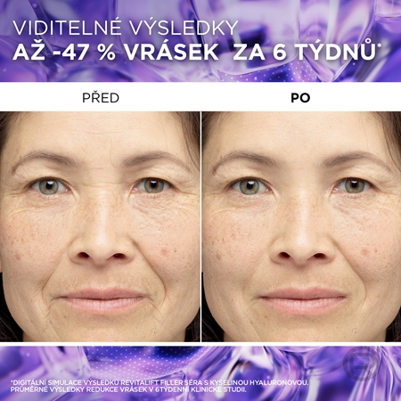 L’Oréal Paris Revitalift Filler sérum proti vráskám s kyselinou hyaluronovou