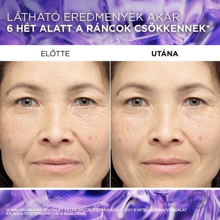 L’Oréal Paris Revitalift Filler ránctalanító szérum hialuronsavval