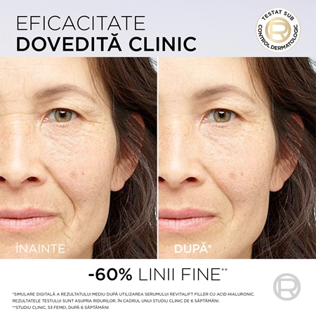 L’Oréal Paris Revitalift Filler ser antirid cu acid hialuronic