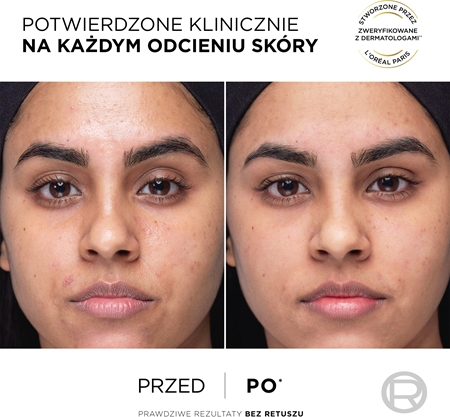 L’Oréal Paris Revitalift serum do twarzy z witaminą C