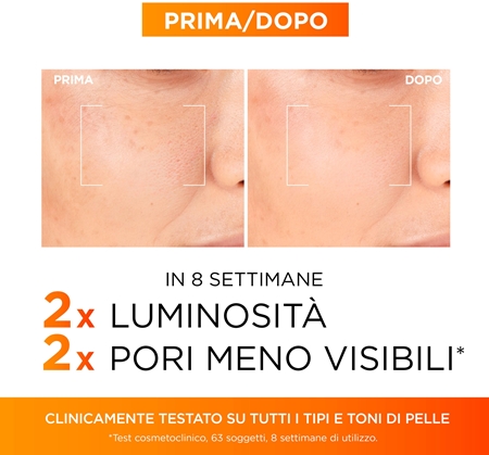 L’Oréal Paris Revitalift Clinical siero viso con vitamina C