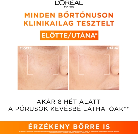 L’Oréal Paris Revitalift Clinical szérum 12% tiszta C-vitaminnal