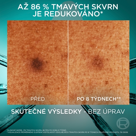 L’Oréal Paris Bright Reveal sérum proti pigmentovým skvrnám