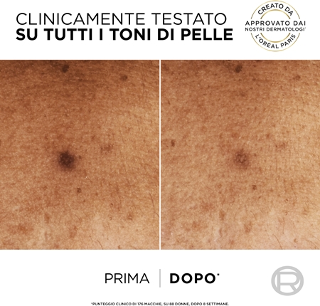 L’Oréal Paris Bright Reveal lozione contro le macchie della pelle SPF 50+