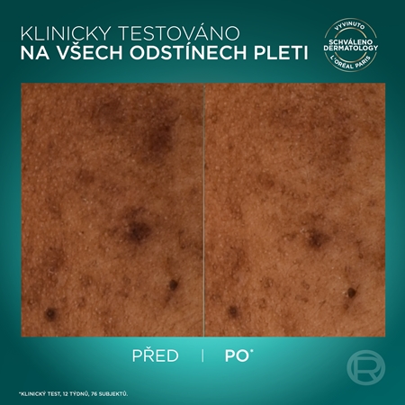 L’Oréal Paris Bright Reveal fluid proti pigmentovým skvrnám SPF 50+