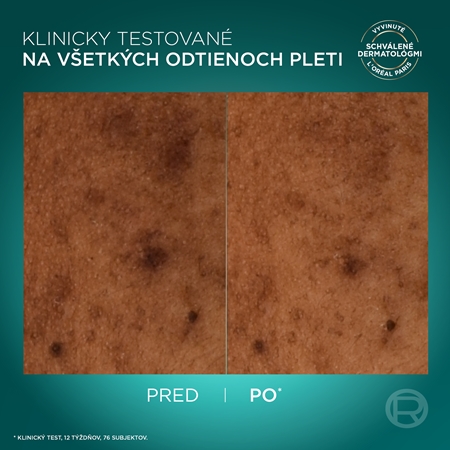 L’Oréal Paris Bright Reveal tekutina proti pigmentovým škvrnám SPF 50+