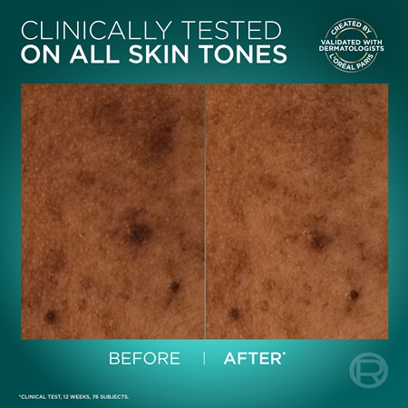 L’Oréal Paris Bright Reveal флуид против пигментни петна SPF 50+