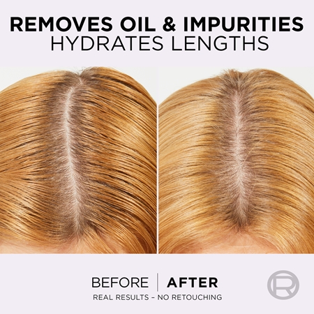 L’Oréal Paris Elvive Hyaluron Pure balsamo per capelli per cuoi capelluti grassi e punte secche