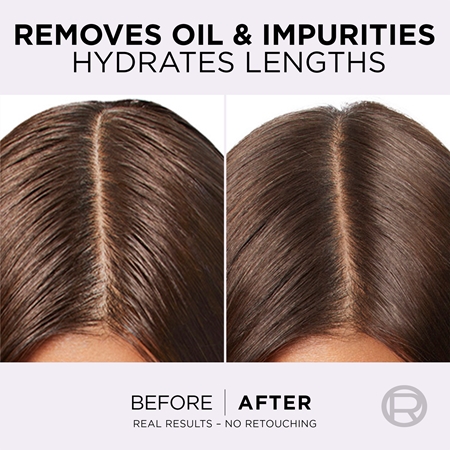 L’Oréal Paris Elvive Hyaluron Pure balsamo per capelli per cuoi capelluti grassi e punte secche
