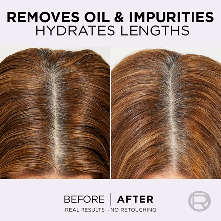 L’Oréal Paris Elvive Hyaluron Pure balsamo per capelli per cuoi capelluti grassi e punte secche