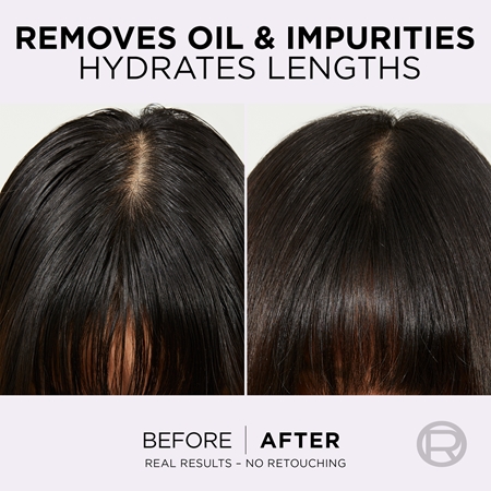 L’Oréal Paris Elvive Hyaluron Pure balsamo per capelli per cuoi capelluti grassi e punte secche