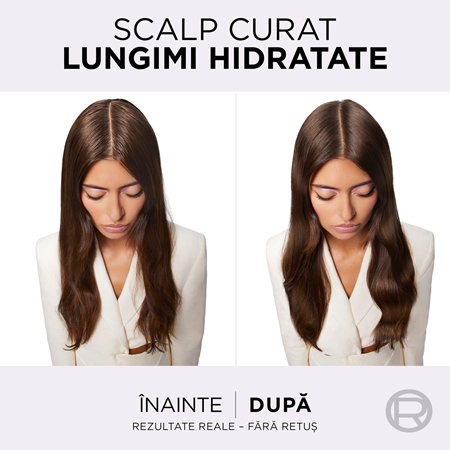 L’Oréal Paris Elseve Hyaluron Pure Ser pentru scalp curățare profundă