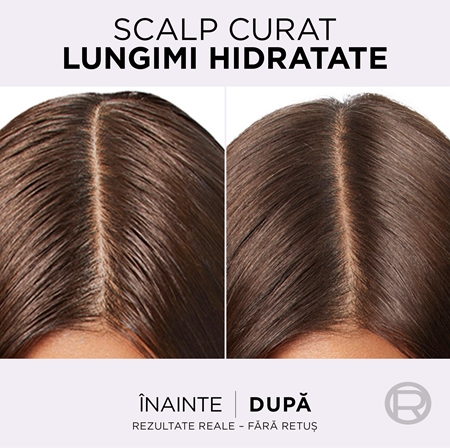 L’Oréal Paris Elseve Hyaluron Pure Ser pentru scalp curățare profundă