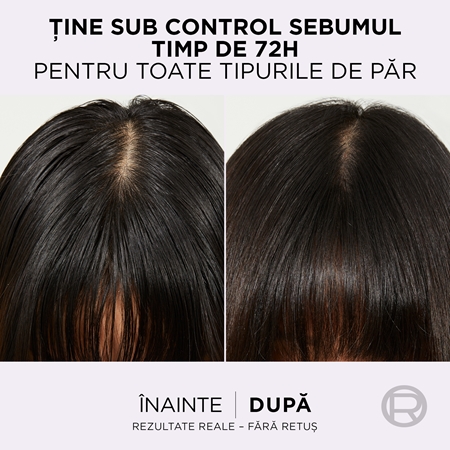 L’Oréal Paris Elseve Hyaluron Pure Ser pentru scalp curățare profundă