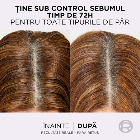 L’Oréal Paris Elseve Hyaluron Pure Ser pentru scalp curățare profundă