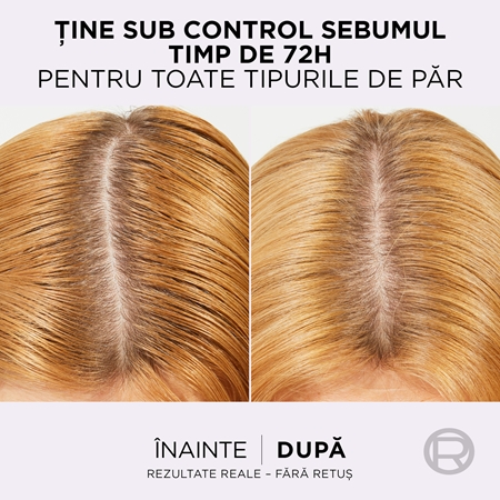 L’Oréal Paris Elseve Hyaluron Pure Ser pentru scalp curățare profundă