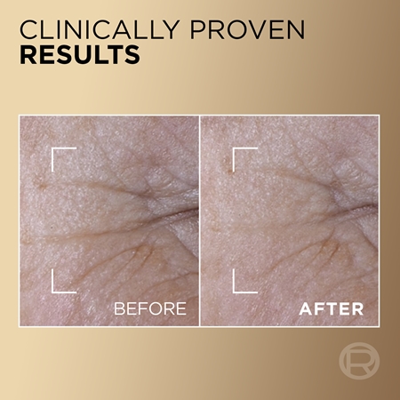 L’Oréal Paris Age Perfect Le Duo Serum bi-phase verjongend serum voor Stralende en Gladde Huid