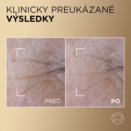 L’Oréal Paris Age Perfect Le Duo Serum dvojfázové omladzujúce sérum pre rozjasnenie a vyhladenie pleti
