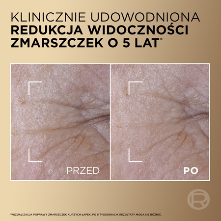 L’Oréal Paris Age Perfect Le Duo Serum dwufazowe serum odmładzające dla efektu rozjaśnienia i wygładzenia skóry