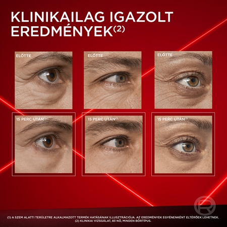 L’Oréal Paris Revitalift Laser sötét karikákra és duzzanatokra való szemkrém