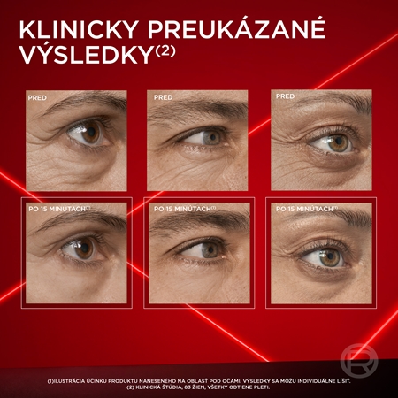 L’Oréal Paris Revitalift Laser očná starostlivosť proti opuchom a tmavým kruhom