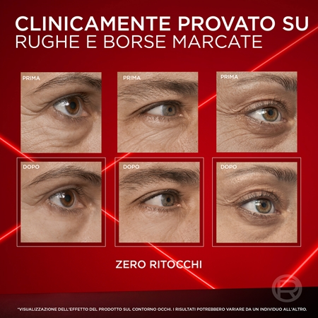 L’Oréal Paris Revitalift Laser crema occhi