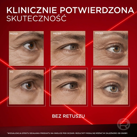 L’Oréal Paris Revitalift Laser Eye Bag Instant Eraser Reduktor cieni i "worków" do odmładzania skóry