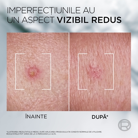 L’Oréal Paris Men Expert Derma Control cremă împotriva imperfecțiunilor cu niacinamidă