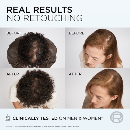 L’Oréal Paris Elvive Growth Booster shampoo rinforzante anti-caduta dei capelli