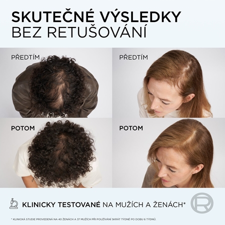 L’Oréal Paris Elseve Growth Booster posilující a regenerační vlasové sérum proti vypadávání vlasů