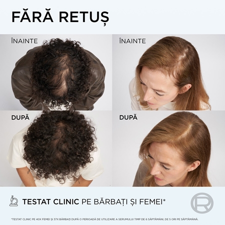 L’Oréal Paris Elseve Growth Booster ser de păr fortifiant și regenerator impotriva caderii parului