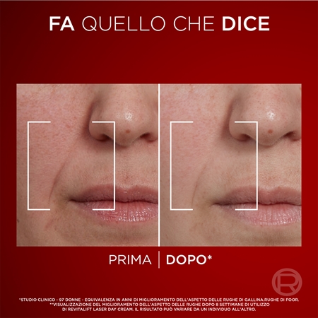 L’Oréal Paris Revitalift Laser crema giorno per il viso nutriente intensa