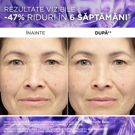 L’Oréal Paris Revitalift Filler ser antirid cu acid hialuronic