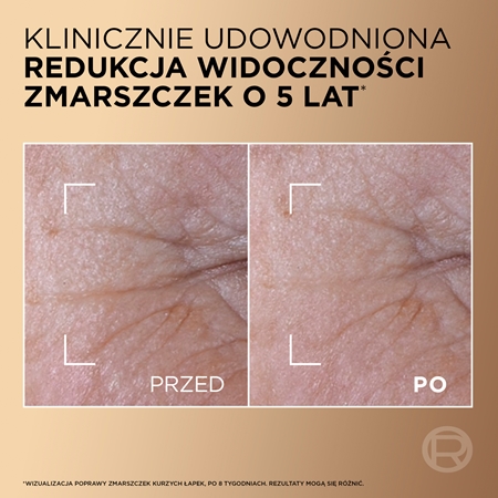 L’Oréal Paris Age Perfect Le Duo Serum dwufazowe serum odmładzające dla efektu rozjaśnienia i wygładzenia skóry