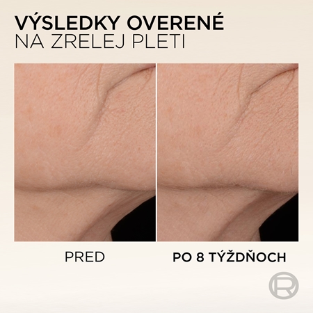 L’Oréal Paris Age Perfect Micro Collagen spevňujúce sérum s peptidmi