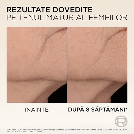 L’Oréal Paris Age Perfect Micro Collagen ser pentru fermitate cu peptide