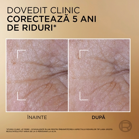 L’Oréal Paris Age Perfect Le Duo Serum ser de reîntinerire în două faze pentru strălucirea și netezirea pielii