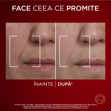 L’Oréal Paris Beauty Set set cadou pentru femei