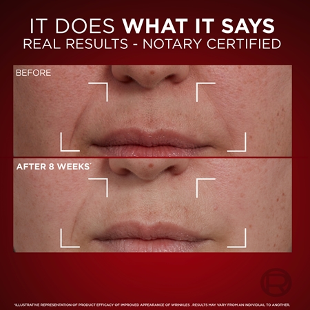 L’Oréal Paris Revitalift Laser set proti staranju kože