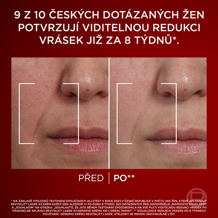L’Oréal Paris Revitalift Laser sada proti stárnutí pleti