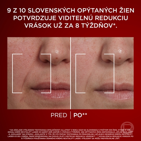 L’Oréal Paris Revitalift Laser sada proti starnutiu pleti