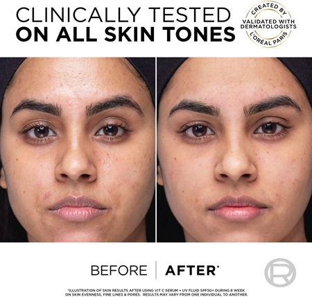 L’Oréal Paris Revitalift Clinical trattamento viso con vitamina C